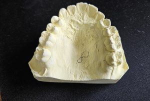 교정 -본-이미지